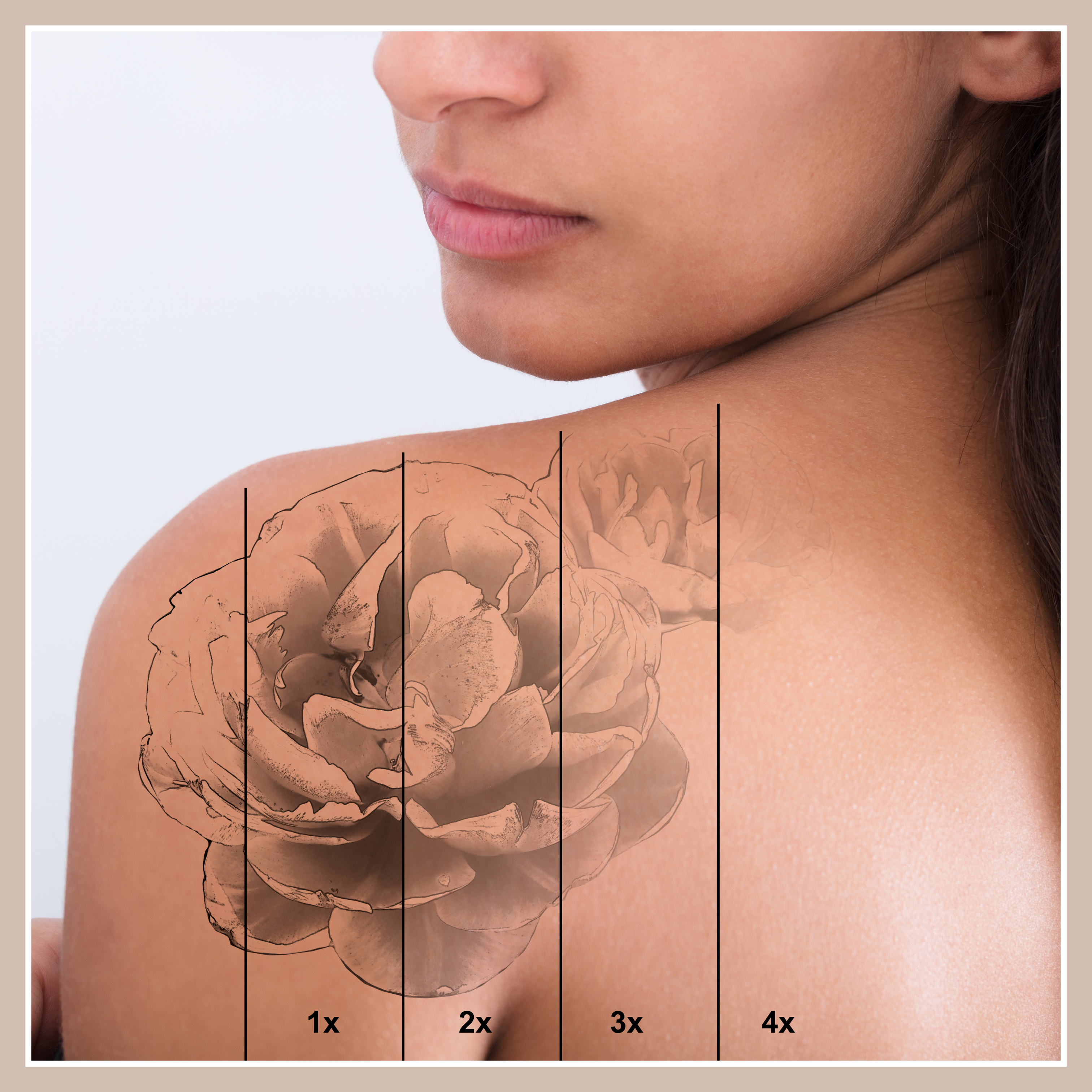 Laser Tattoo & Hair Removal - The Beauty Space